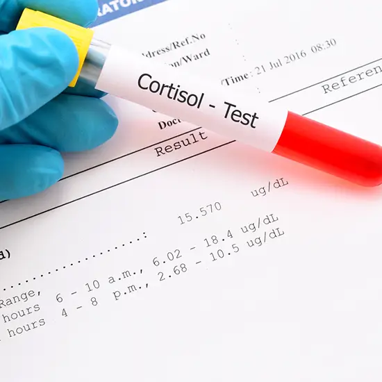 cortisol, serum (morning and evening sample) test